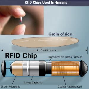 ObamaCare Implant: ObamaCare Microchip RFID Myth